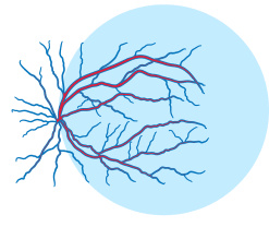 A simplified diagram of the human eye, showing the blood vessels in the retina. The central retinal artery and vein are highlighted in red and blue, respectively.