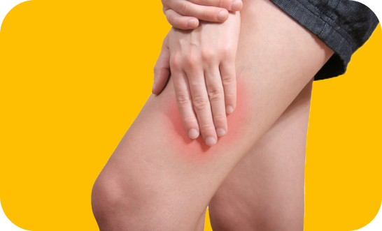 Burning Legs, vein disease