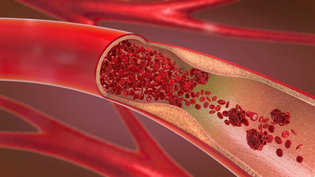 A cross-section of a blood vessel, showing red blood cells flowing through it. The vessel walls are lined with endothelial cells.