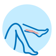 A simplified illustration of a leg with a red, irritated area on the calf, indicating a potential sign of peripheral arterial disease