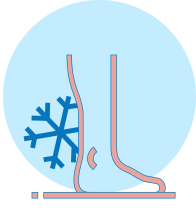 A simplified illustration of a leg with a snowflake near the ankle, indicating cold sensitivity associated with Raynaud's disease.