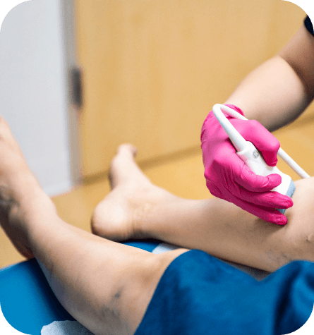 Sclerotherapy checkup