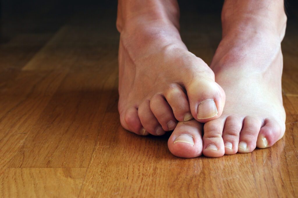 Chronically Cold Feet: Why Are My Feet Always so Cold