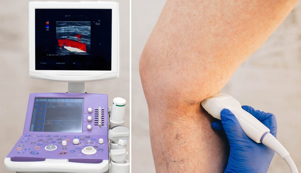 Diagnostic Venous Ultrasound