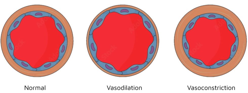 A diagram showing normal, dilated, and constricted blood vessels, with a focus on how changes in vessel size can contribute to leg pain.