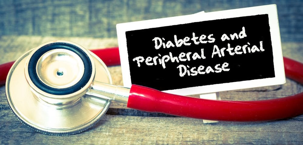 Diabetes and peripheral arterial disease, photo