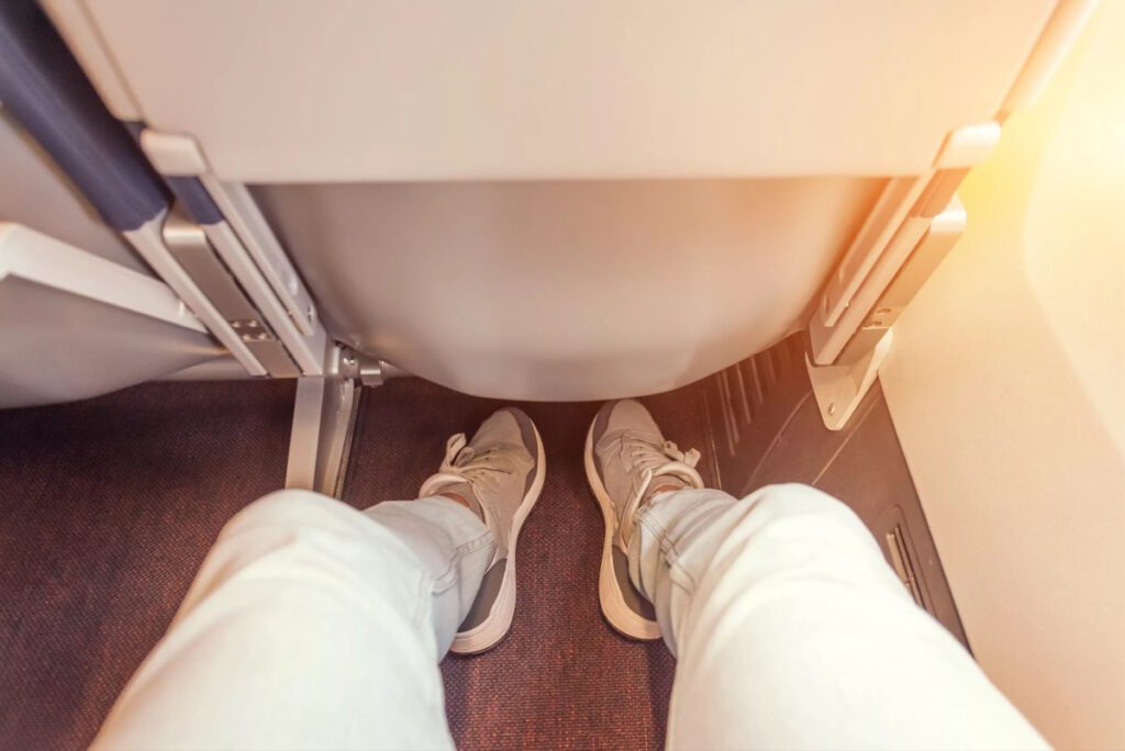 View of a passenger's legs with varicose veins, showing limited legroom on a plane