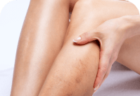 Close-up image of a person's hand examining their own leg