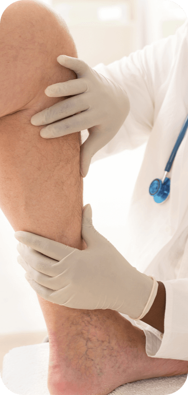 A close-up image of a medical professional examining a patient's leg