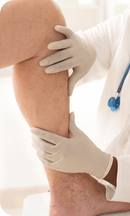 varicose veins, Doctor examining patient's leg