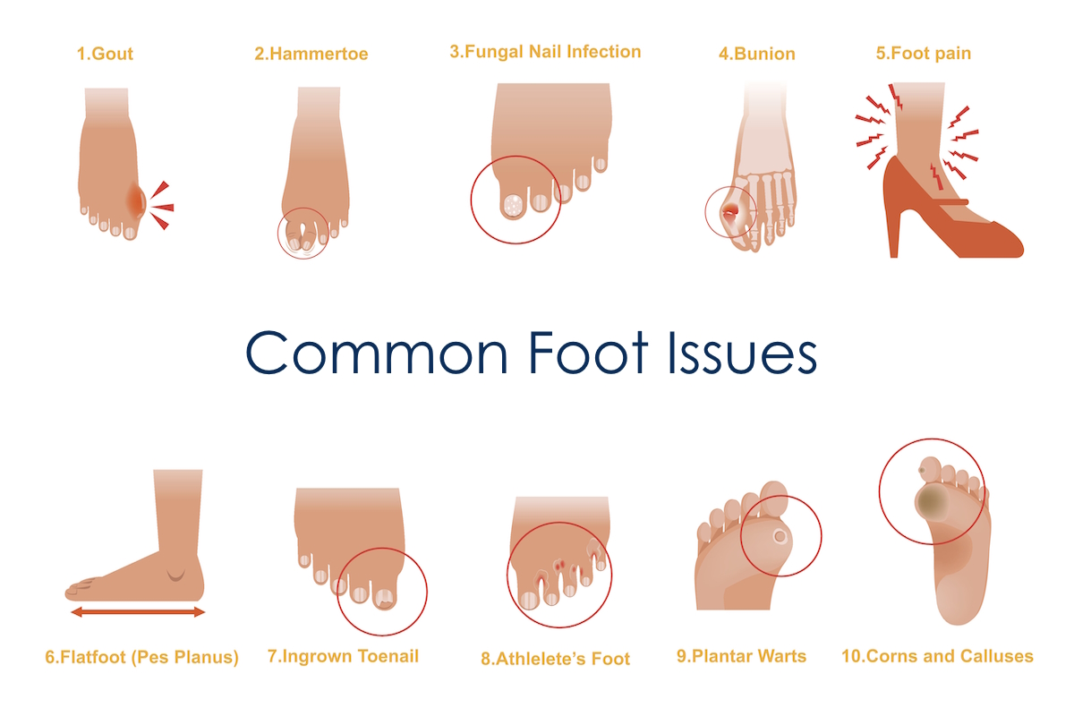 foot pain common foot conditions